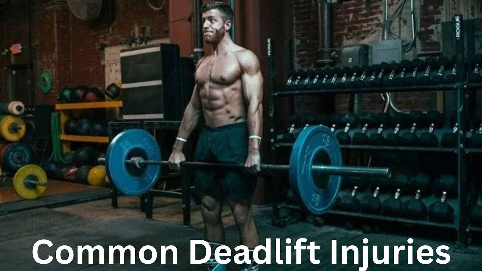 Common Deadlift Injuries Every Lifter Should Know