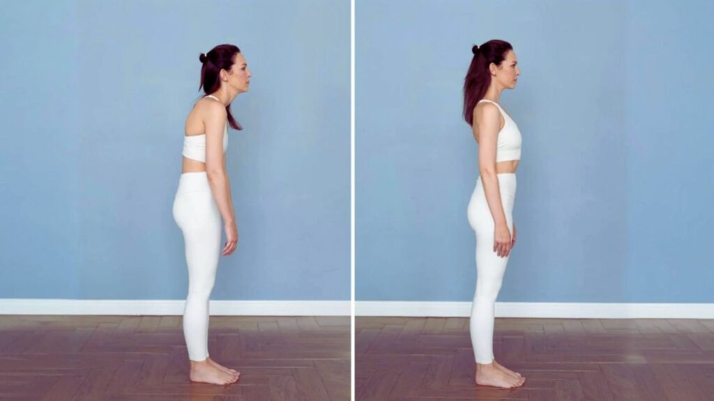 Sway Back Posture: Causes, and How to Fix It - XcelerateGyms