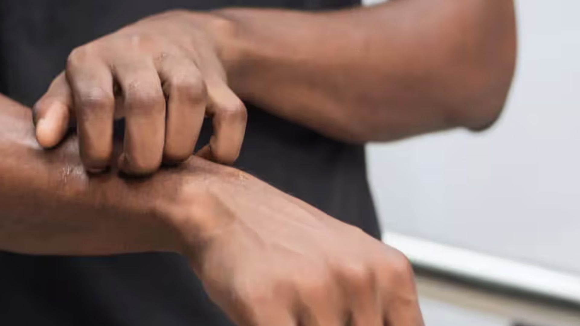 How Much Beta-Alanine Causes Itching