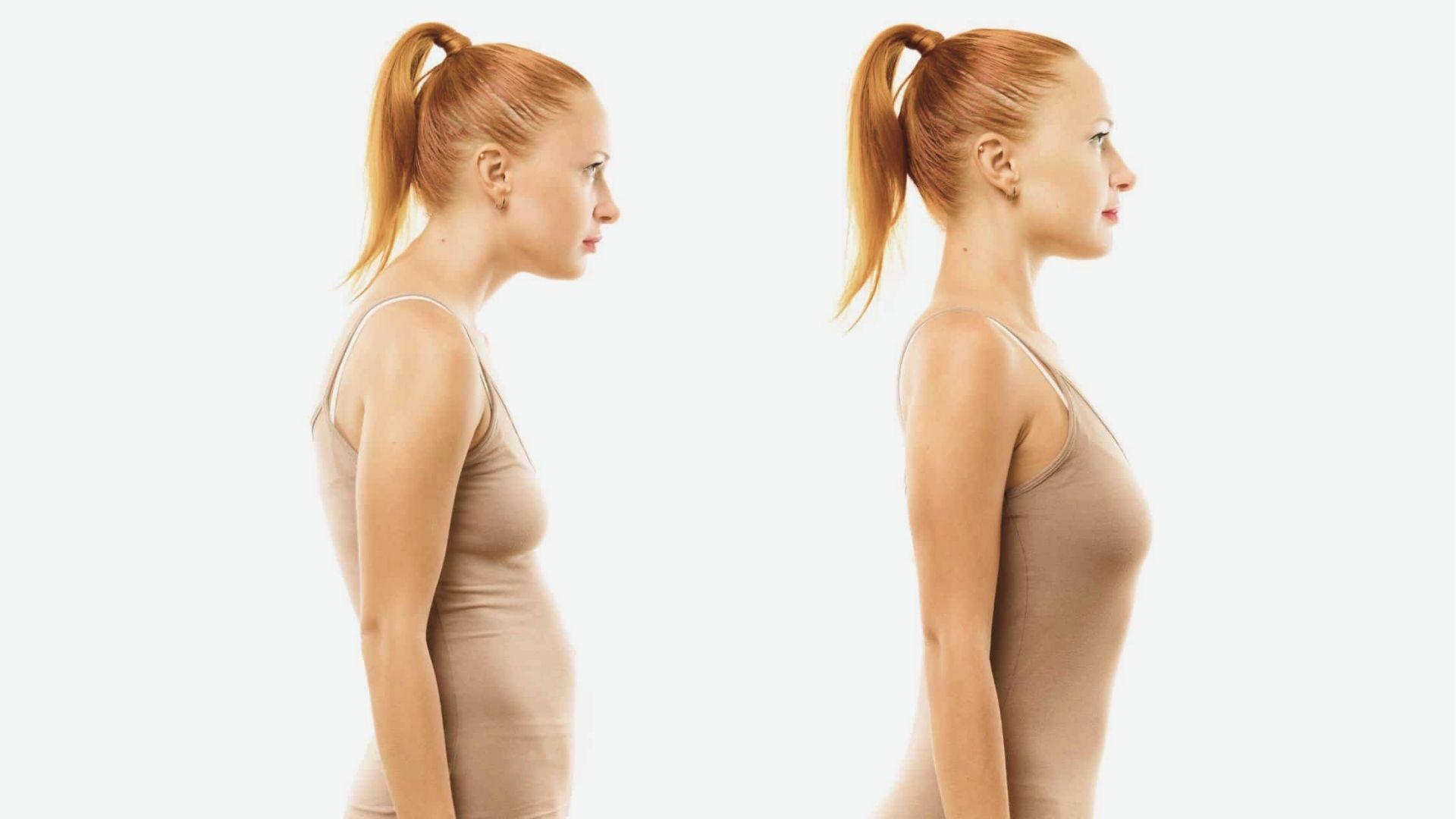 Side-by-side comparison of woman with slouched posture vs. upright posture in beige outfit.